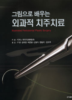 그림으로배우는외과적치주지료