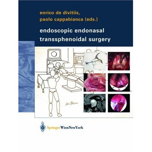 Endoscopic Endonasal Transsphenoidal Surgery