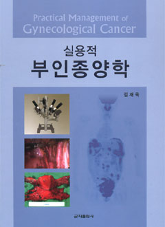 실용적부인종양학