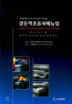 경동맥초음파메뉴얼