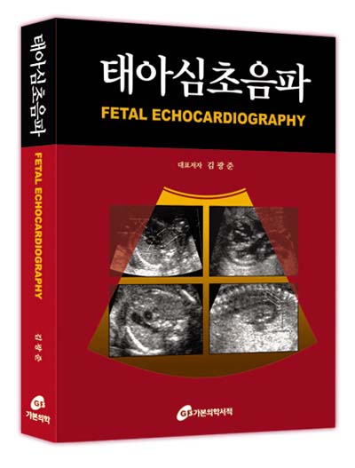 태아심초음파
