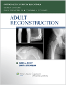 Adult Reconstruction