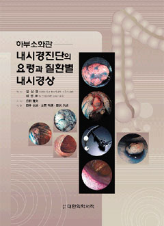 하부소화관 - 내시경 질환의 요령과 질환별 내시경상