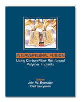 Intervertebral Fusion Using Carbon Fiber Reinforced Polymer Implants 2DVD Include