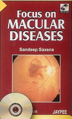 Focus on Macular Diseases
