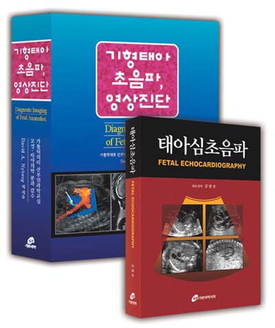 기형태아 초음파 영상진단 + 태아심초음파 세트 할인판매