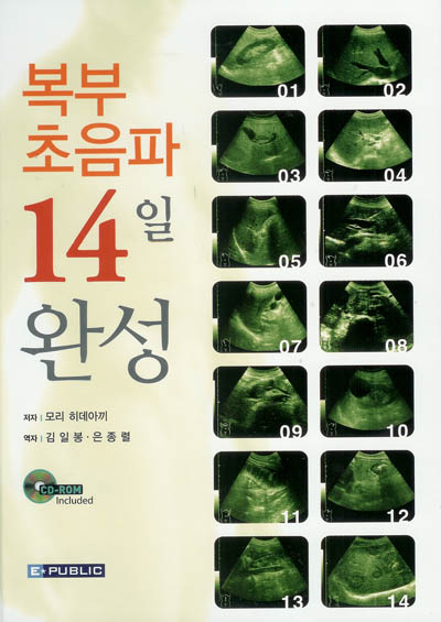 복부초음파14일완성(DVD포함)