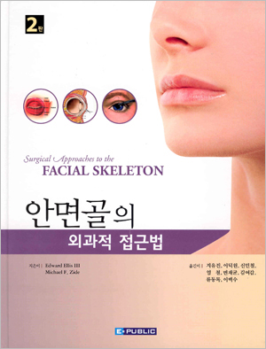 안면골의 외과적 접근법
