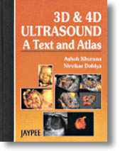 3D and 4D Ultrasound
