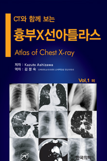 흉부X선 아틀라스