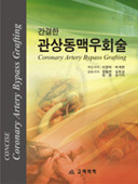 간결한관상동맥우회술