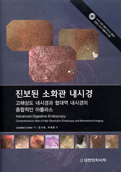 진보된 소화관 내시경-고해상도 내시경과 협대역 내시경의 종합적인 아틀라스