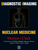 Diagnostic Imaging: Nuclear Medicine