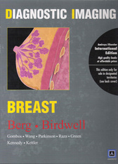 Diagnostic Imaging: Breast