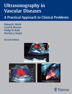 Ultrasonography in Vascular Diseases 2e