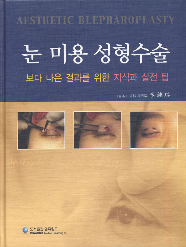 눈 미용 성형수술 - 보다 나은 결과를 위한 지식과 실전 팁