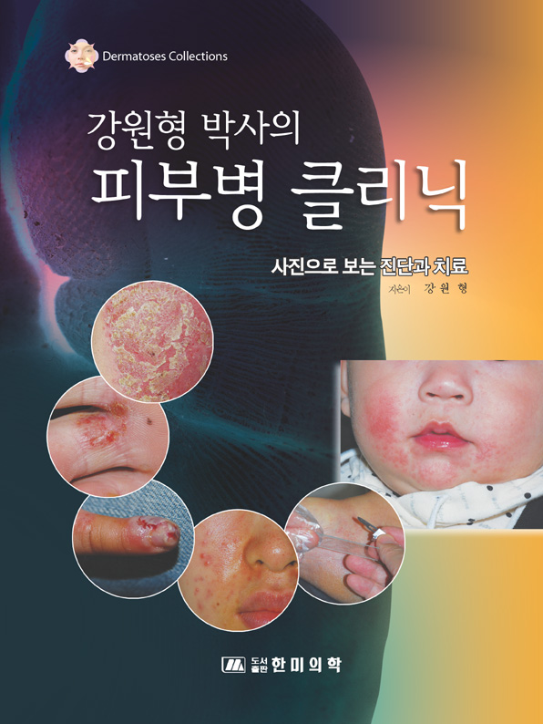 강원형박사의 피부병클리닉