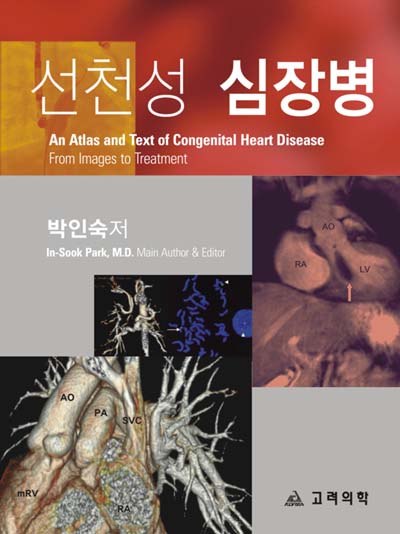 선천성심장병 2판