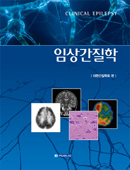 임상간질학