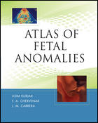 Atlas of Fetal Anomalies