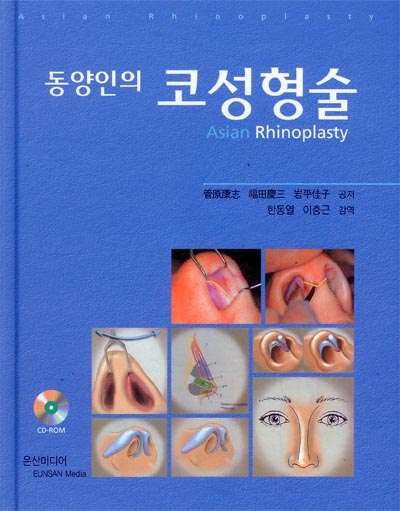 동양인의 코성형술 (with CD-ROM)