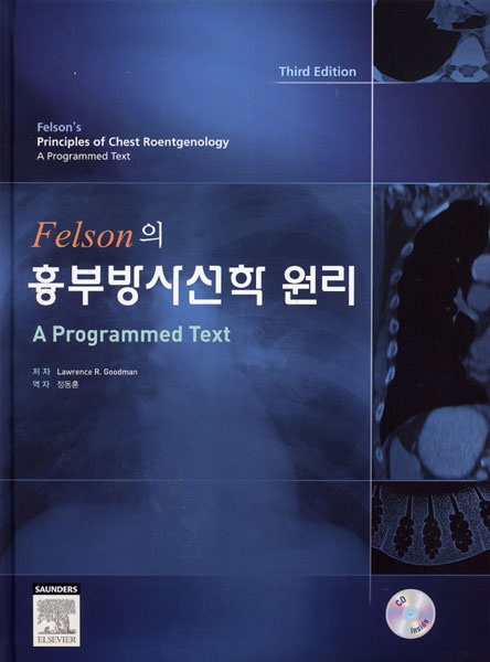 Felson의 흉부방사선학 원리