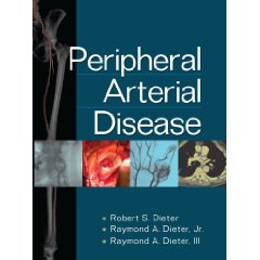 Peripheral Arterial Disease