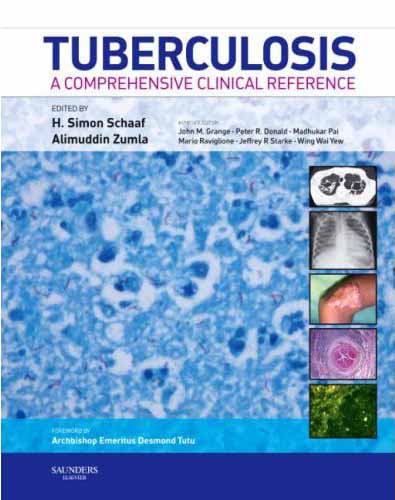 Tuberculosis - A Comprehensive Clinical Reference