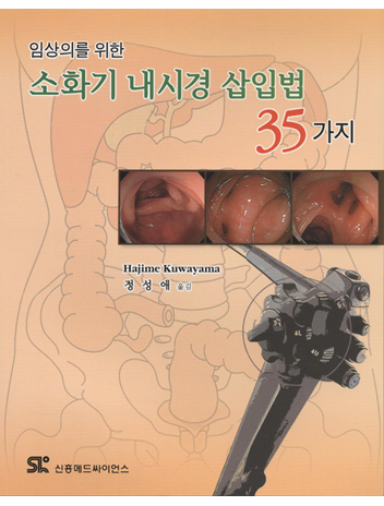 임상의를 위한 소화기내시경삽입법35가지