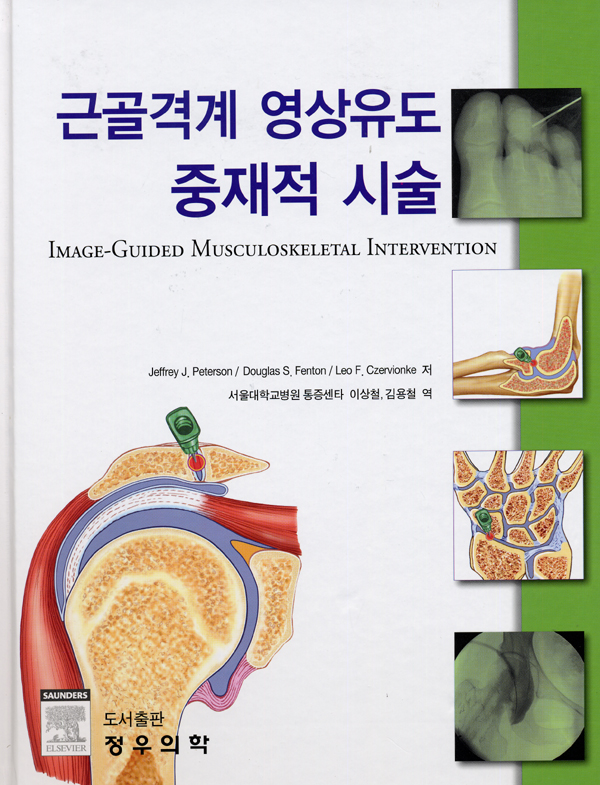 근골격계 영상유도 중재적 시술