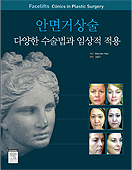 안면거상술-다양한수술법과 임상적적용