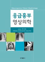 응급흉부영상의학