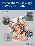 Interventional Radiology in Women's Health