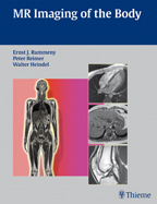 MR Imaging of the Body
