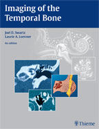 Imaging of the Temporal Bone