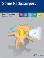 Spine Radiosurgery