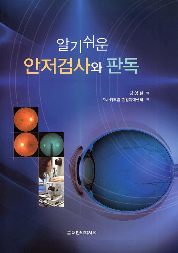 알기쉬운 안저검사와 판독