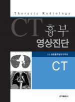 흉부영상진단CT