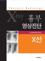 흉부영상진단X선
