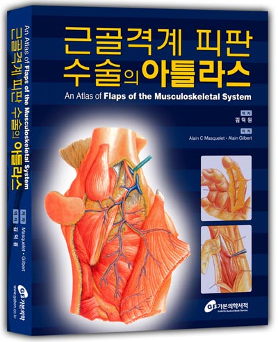 근골격계피판수술의 아틀라스