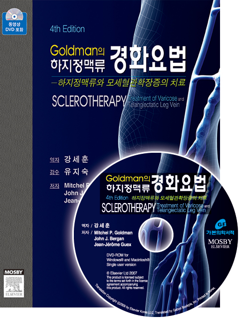 Goldman의 하지정맥류 경화요법-4판
