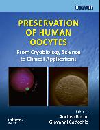 Preservation of Human Oocytes