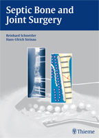 Septic Bone and Joint Surgery