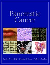 Pancreatic Cancer