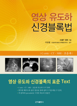 영상 유도하 신경블록법