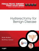 Hysterectomy for Benign Disease: Female Pelvic Surgery Video Atlas Series