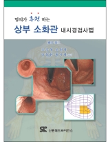 명의가 추천하는 상부소화관 내시경검사법