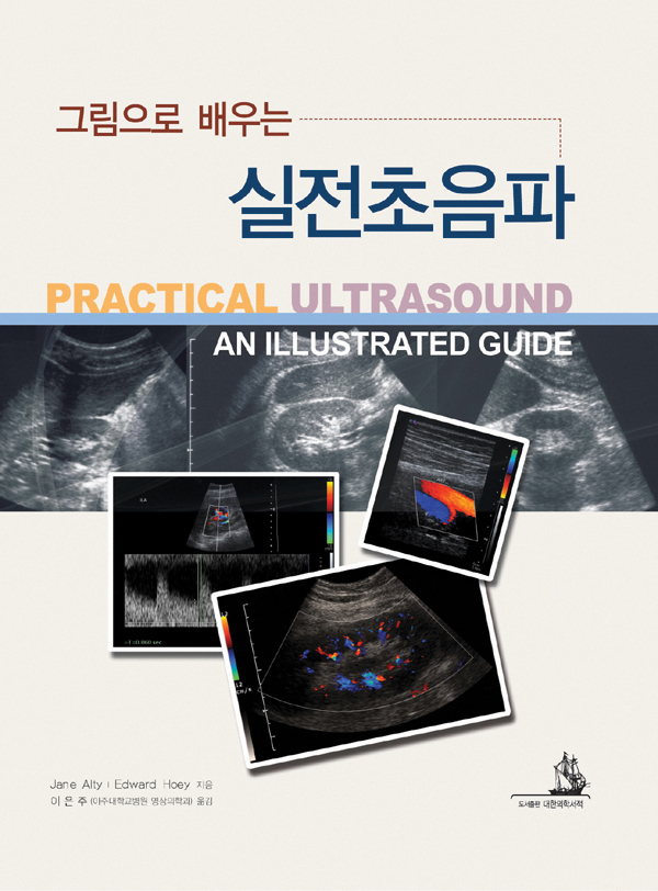 실전초음파 - 그림으로 배우는