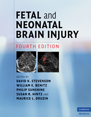 Fetal and Neonatal Brain Injury-4판