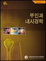 부인과내시경 2판